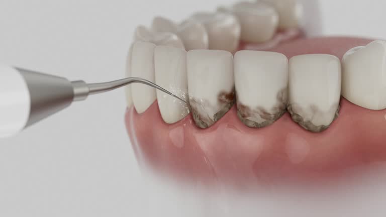 Trusted Tooth Extraction service in Lockland, OH - Dentist Open Now